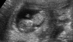 Semana 9 de embarazo - inatal - El embarazo semana a semana